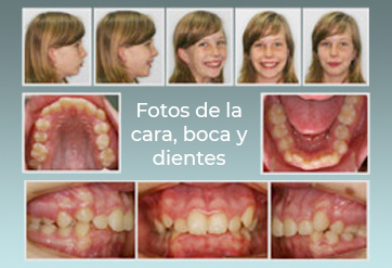 Fotografías faciales
